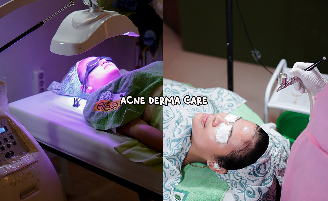 SOLUTION TREATMENT ACNE DERMA CARE | Blog | Brisha Store