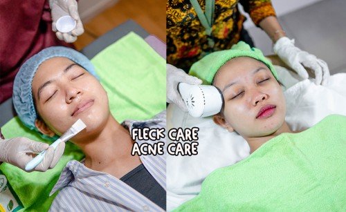 SOLUTION TREATMENT ACNE CARE/FLECK CARE | Brisha Store