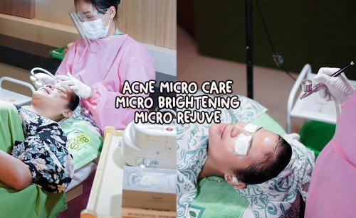 SOLUTION TREATMENT ACNE MICRO CARE/MICRO BRIGHTENING/MICRO REJUV | Brisha Store