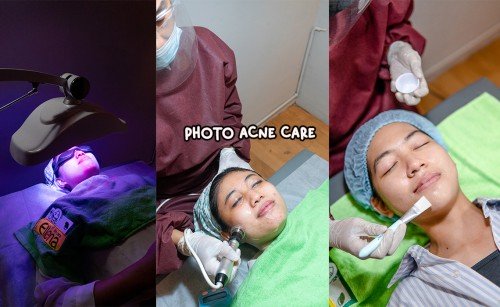 SOLUTION TREATMENT PHOTO ACNE CARE | Brisha Store