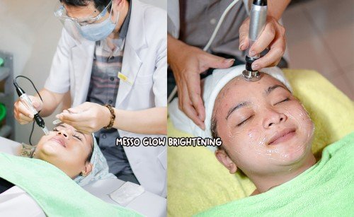 SOLUTION TREATMENT MESSO GLOW BRIGHTENING FREE SERUM | Brisha Store