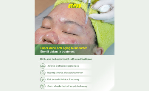 SUPER ACNE ANTI AGING SKINBOOSTER | Brisha Store